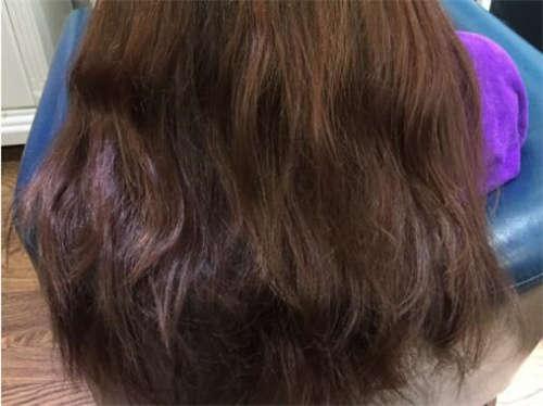 天津市众大口腔门诊部牙齿治疗费用揭秘：烤瓷牙3K+ 隐形矫正2W+ 种植牙1W+